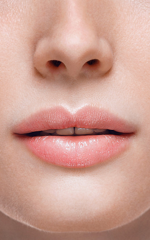 Clínica Vieira - Tratamiento de medicina estética para los labios