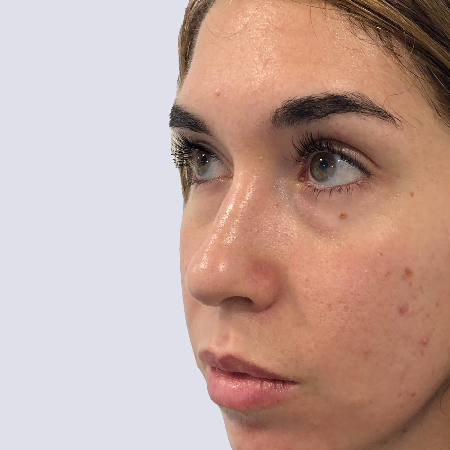 Clínica Vieira - Tratamientos faciales para corregir las ojeras